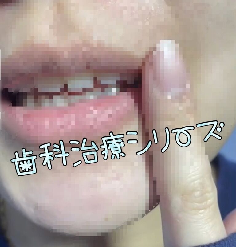 続・歯科治療レポート④